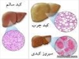  افتتاح درمانگاه بیماریهای گوارشی ، کبدی بالغین